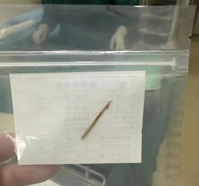 九游娱乐平台：2岁女孩突然腹痛去医院一看令人心惊！不少孩子都有这个习惯(图2)