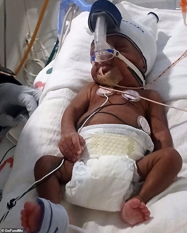 九游娱乐网站：美国女子脑死亡被迫生下孩子婴儿重病难出院(图2)